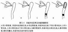 泪道狭窄